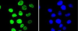 MSK1/RPS6KA5 Rabbit anti-Human, Rat, Clone: SN63-05, Novus Biologicals 100 &mu;L | Buy Online | Novus Biologicals | Fisher Scientific